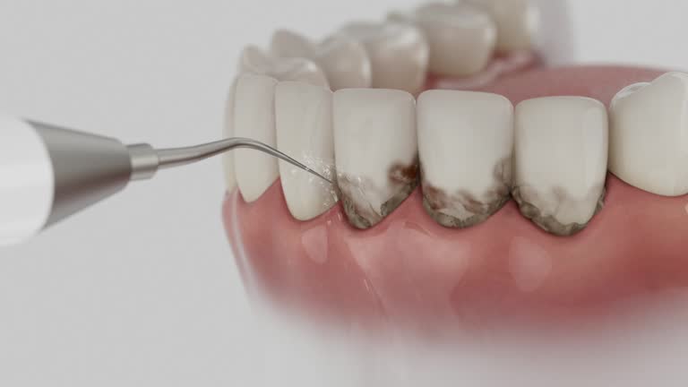 Reliable Tooth Extraction contractor in Cass City, MI by Smile Center Dentistry
